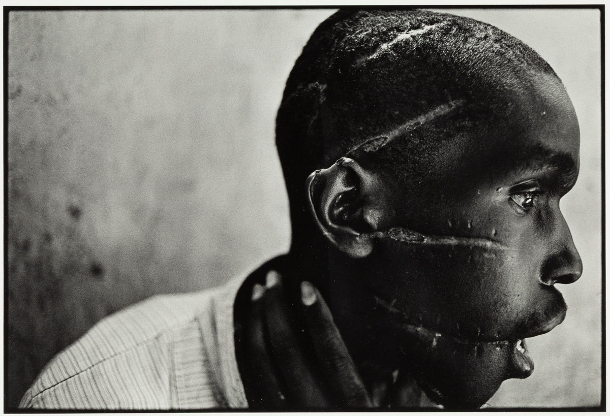 James Nachtwey — Survivor of Hutu death camp, Rwanda — historical auction photograph 1