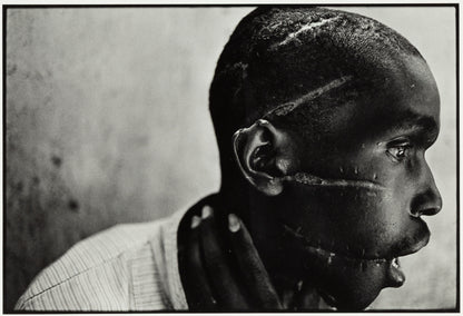 James Nachtwey — Survivor of Hutu death camp, Rwanda — historical auction photograph 1