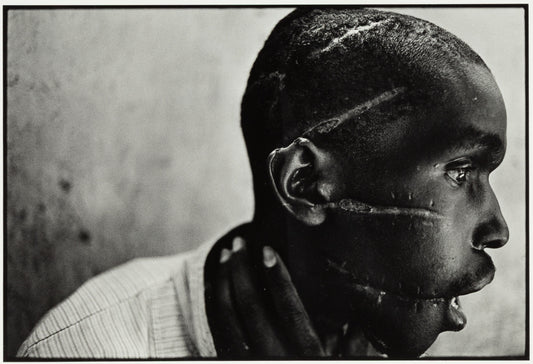 James Nachtwey — Survivor of Hutu death camp, Rwanda — historical auction photograph 1