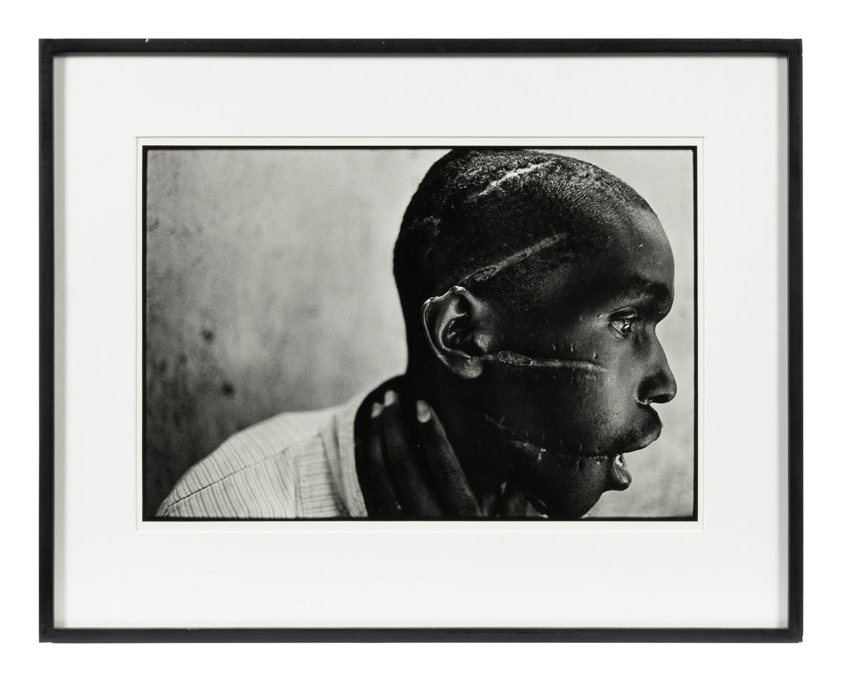 James Nachtwey — Survivor of Hutu death camp, Rwanda — historical auction photograph 2