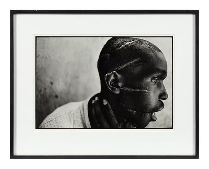 James Nachtwey — Survivor of Hutu death camp, Rwanda — historical auction photograph 2