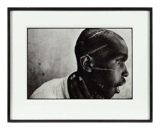 James Nachtwey — Survivor of Hutu death camp, Rwanda — historical auction photograph 2